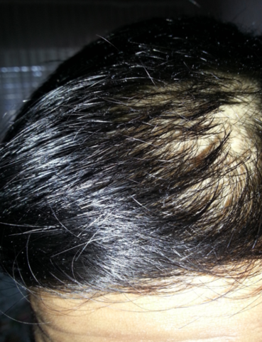 Meine Haare - (Haare, Haut, Kopf)