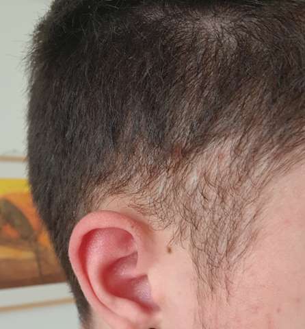 sehr undichtes haar an den seiten