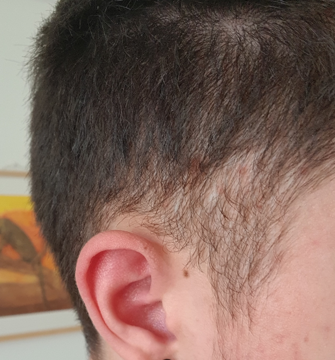 sehr undichtes haar an den seiten