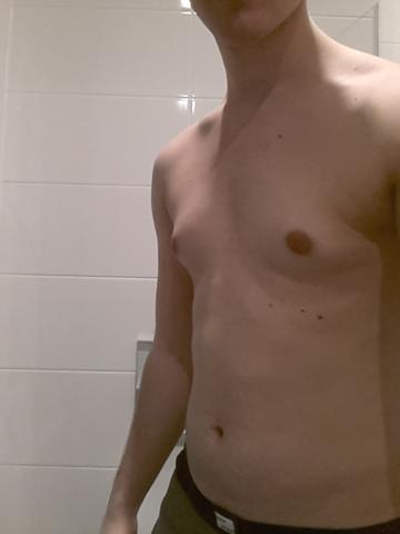 - (Muskeln, Brust)