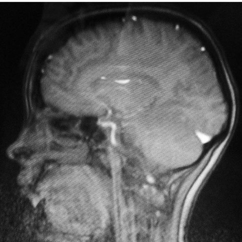 Könnt ihr etwas sagen? Gesund, nicht gesund ? - (Medizin, Neurologie, MRT)