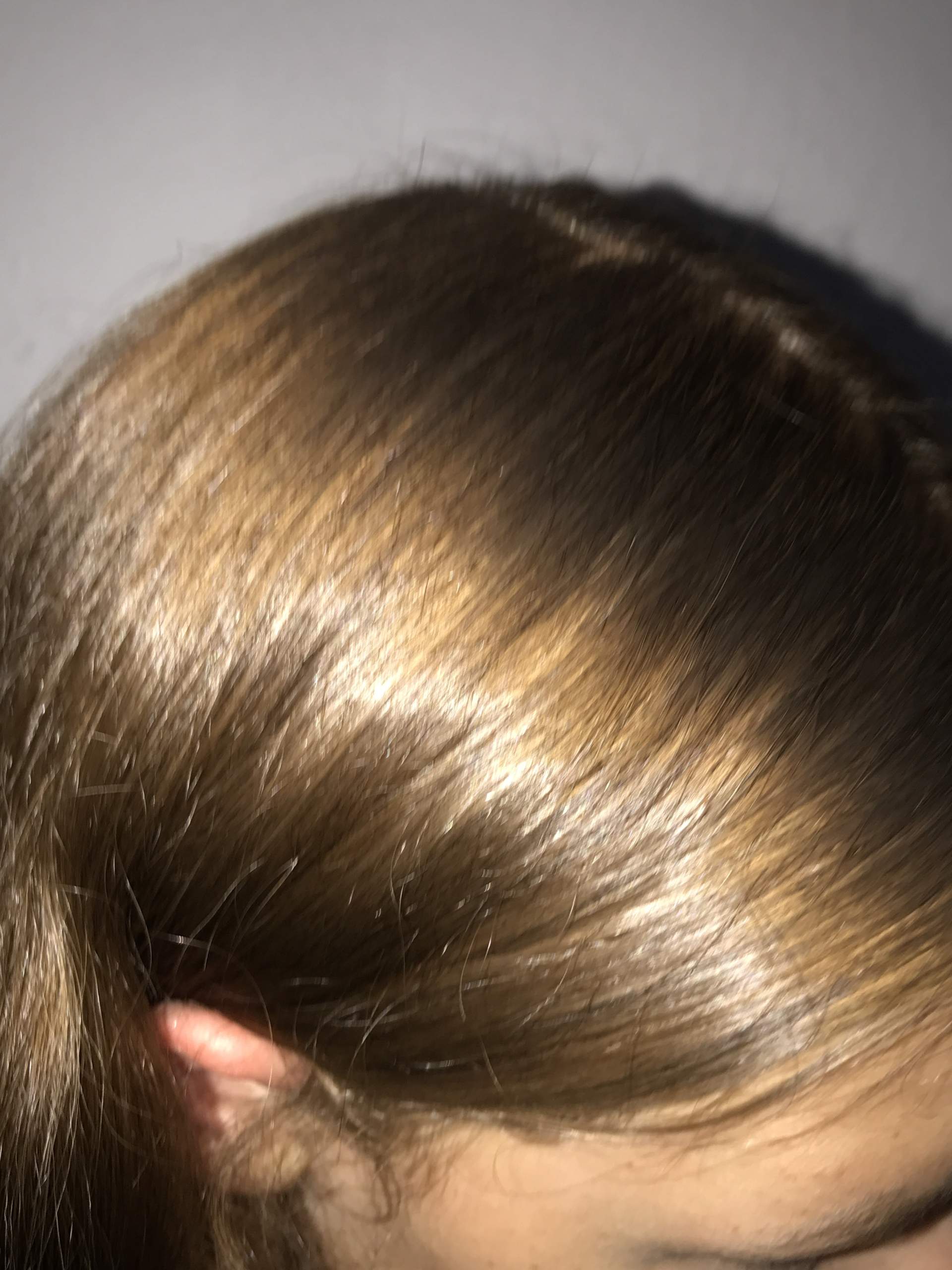 Seht ihr hier einen rotstich? (Haare, Haarfarbe, Rotstich entfernen)