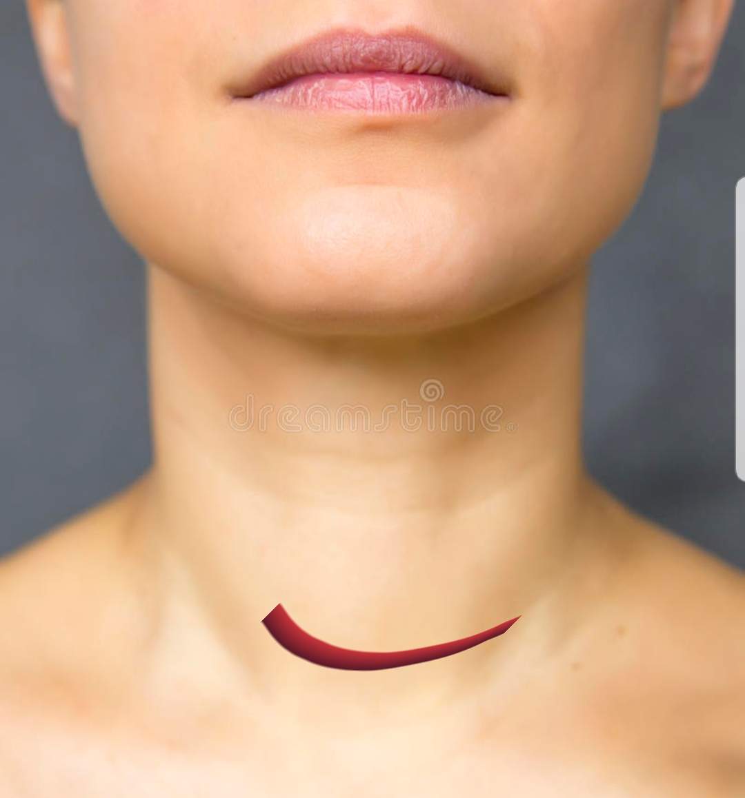 Seit 3 Tagen komisches Gefühl im Hals was könnte es sein? (Gesundheit