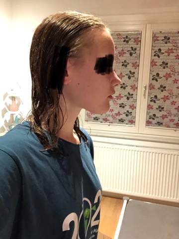 Seltsames Doppelkinn Loswerden Gesundheit Und Medizin Sport Korper