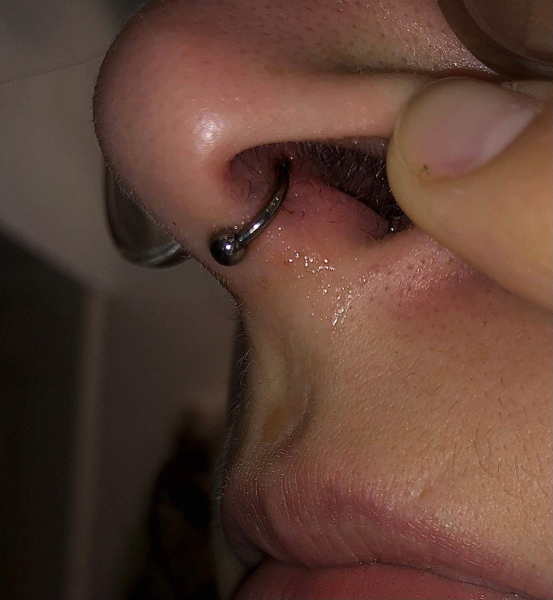 Warum läuft meine Nase nach einem Septumpiercing so stark?