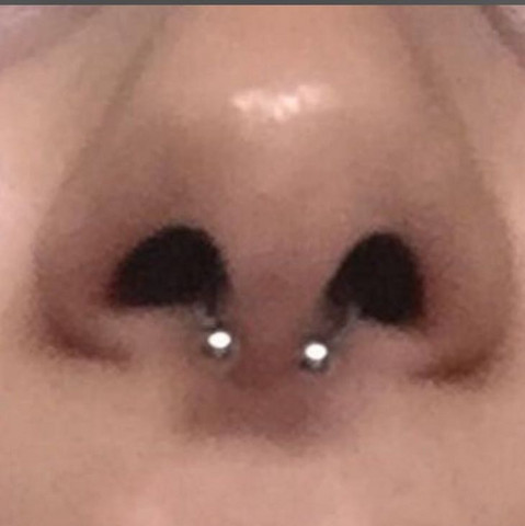 Septum Zu Weit Hinten Gestochen Piercing Septum Zu Weit Hinten Gestochen Piercing