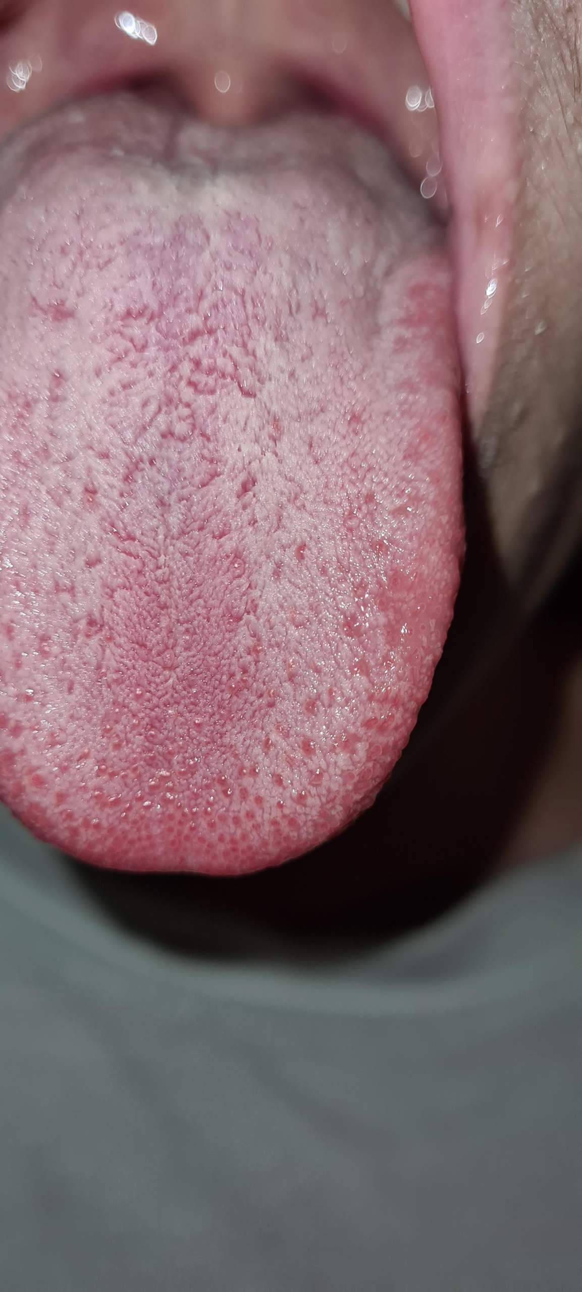 Sieht Das Aus Wie Eine Gesunde Zunge Gesundheit Hygiene Mund Sieht Das Aus Wie Eine Gesunde Zunge Gesundheit Hygiene Mund