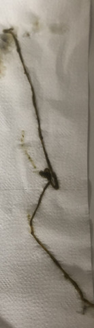 Sieht Das Nach Einem Wurm Aus Gesundheit Und Medizin Gesundheit Medizin Sieht Das Nach Einem Wurm Aus Gesundheit Und Medizin Gesundheit Medizin