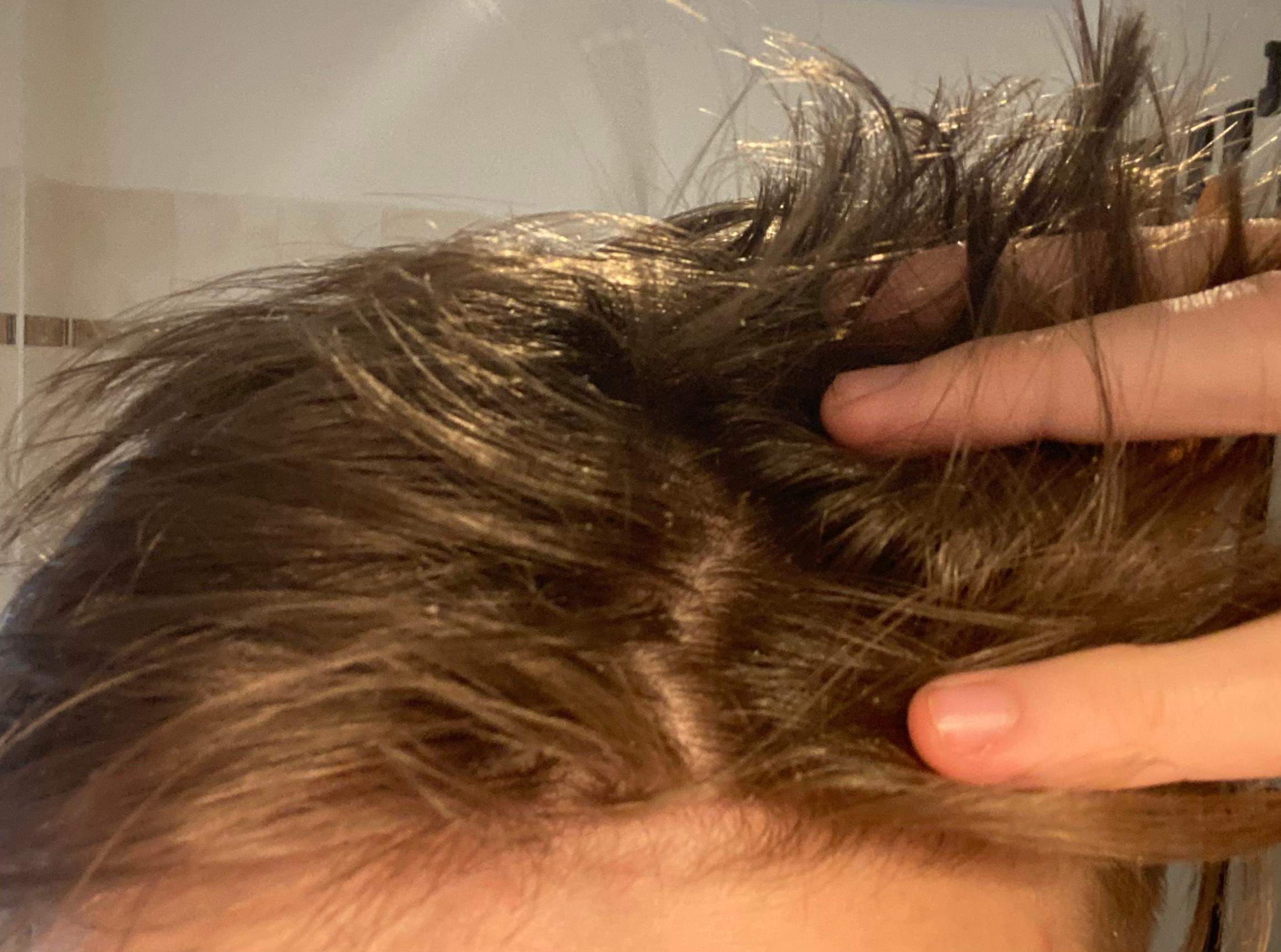 Sieht das nach Haarausfall aus? (Pubertät, Pflege, Friseur)