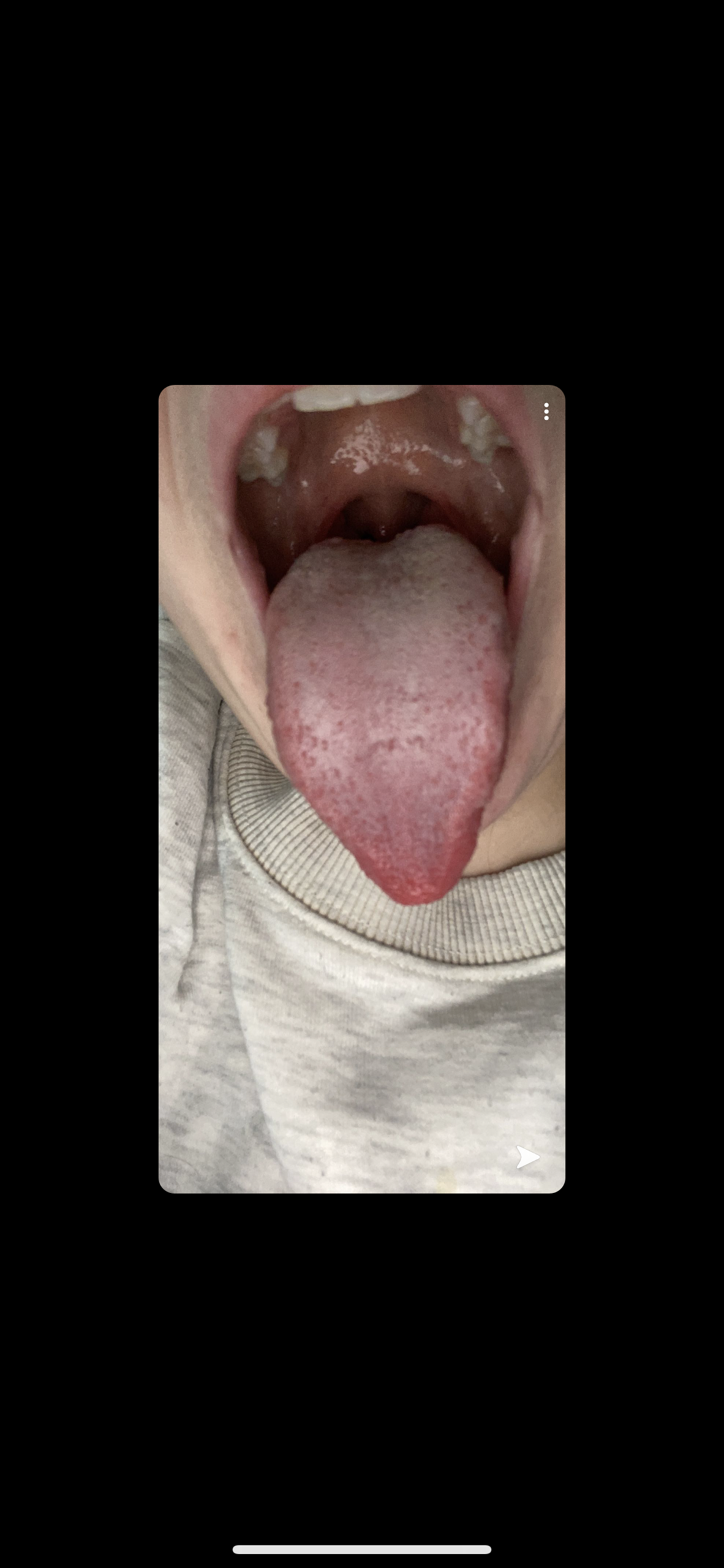 Sieht das normal aus wenn man krank ist? (Gesundheit und Medizin, Gesundheit) Sieht das normal aus wenn man krank ist? (Gesundheit und Medizin, Gesundheit)