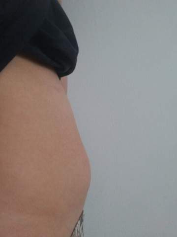 Sieht Das Schwanger Aus Bitte Ich Muss Es Sofort Wissen Schwangerschaft Sieht Das Schwanger Aus Bitte Ich Muss Es Sofort Wissen Schwangerschaft