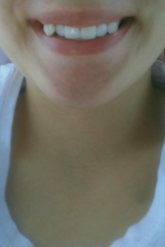 Meine Zähne  - (Zähne, Vampire)