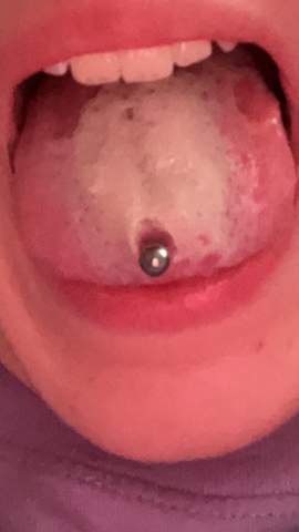 Sieht die Zunge meiner Freundin normal aus (1woche alt)?