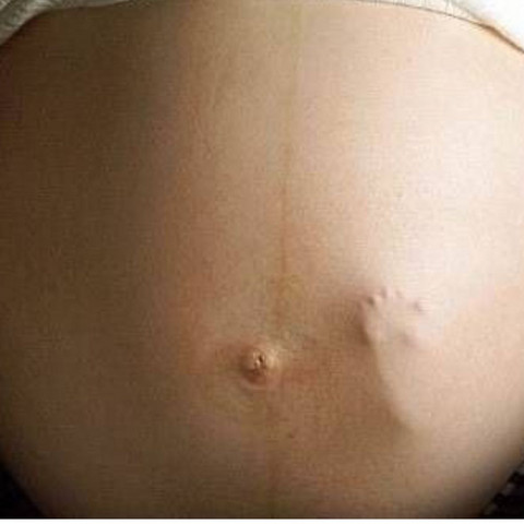 Sieht Man Sowas Wirklich Wenn Man Schwanger Ist Baby Sieht Man Sowas Wirklich Wenn Man Schwanger Ist Baby