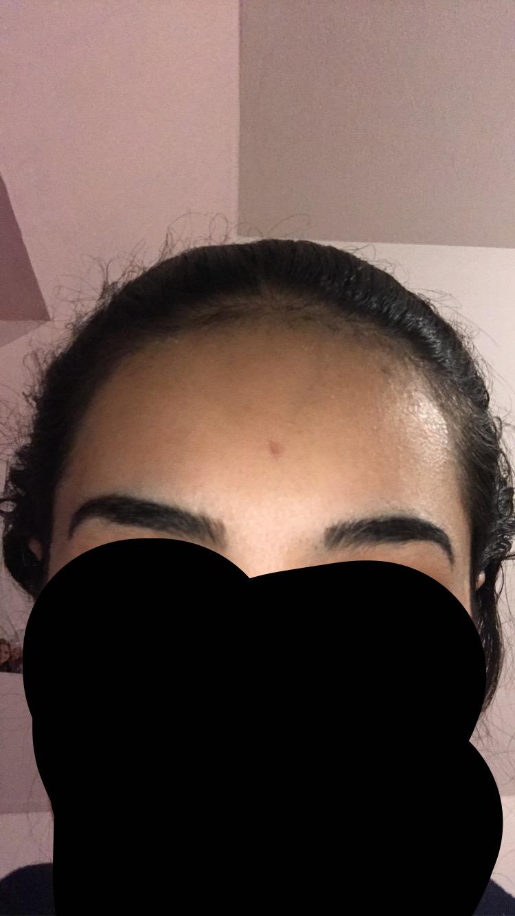 sieht mein haaransatz hasslich aus