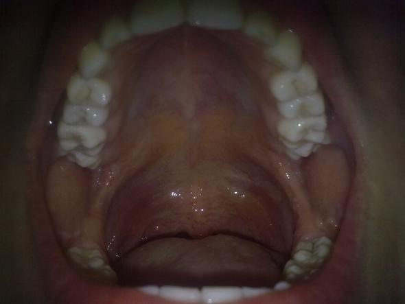 Mundhöhle - (Gesundheit, Arzt, Zähne)