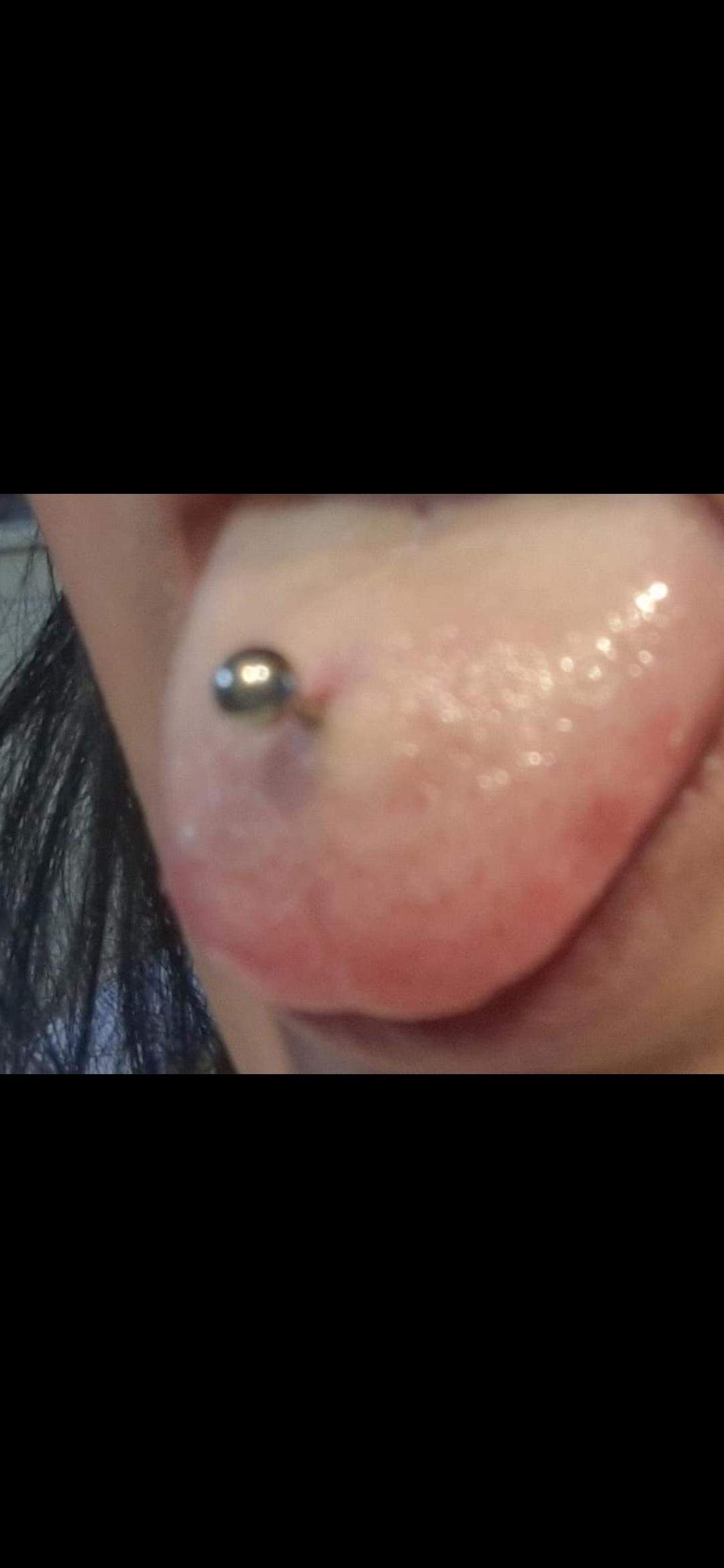 sieht meine Zungenpiercing normal aus? Hab ich Eiter? (Piercing, Zunge, Sekret)
