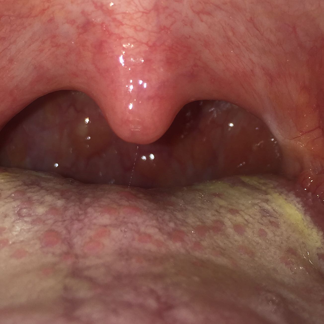 Wie Sieht Ein Scheidenpilz Aus Wie sieht ein guter Trainingsplan aus Wie Sieht Ein Scheidenpilz Aus Wie sieht ein guter Trainingsplan aus