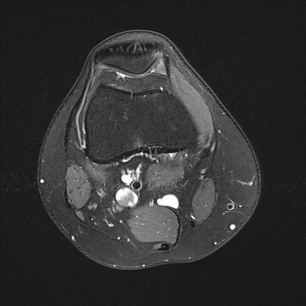 3. - (Medizin, Knie, Bewegung)