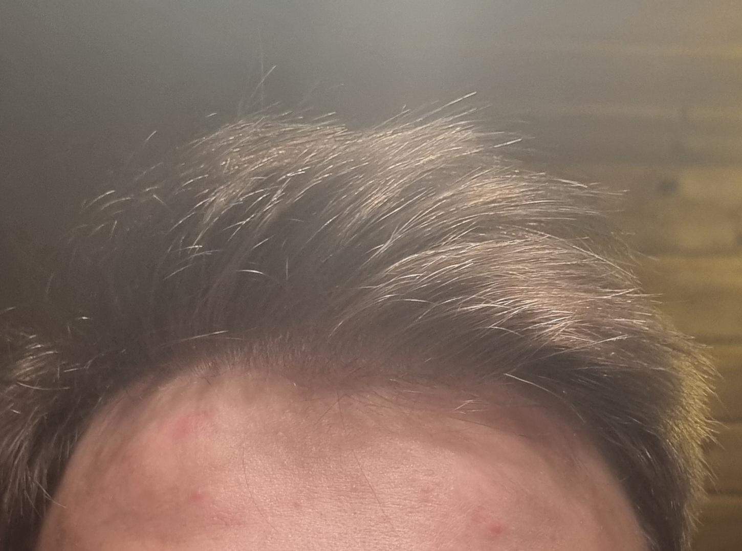 Sind das anzeichen von haarausfall? (Männer, Pubertät, Friseur)