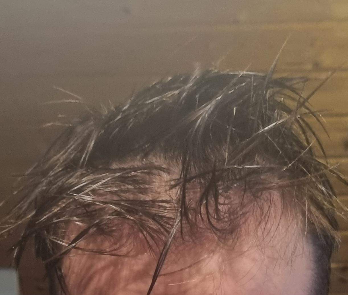 Sind das anzeichen von haarausfall? (Männer, Pubertät, Friseur)