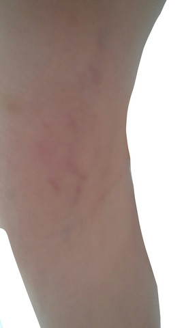 bild 2 - (Arzt, Haut, Beine)