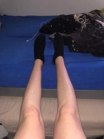 Sind das für euch normale Knie?
