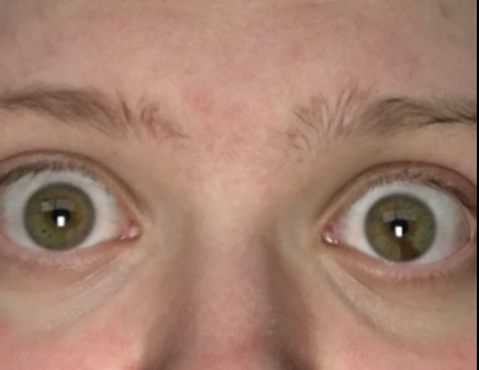 Augen - (Arzt, Augen, Farbe)