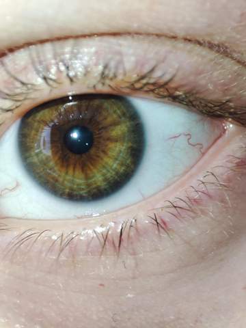 Sind das Hazel eyes oder ist das zentrale Heterochromia?