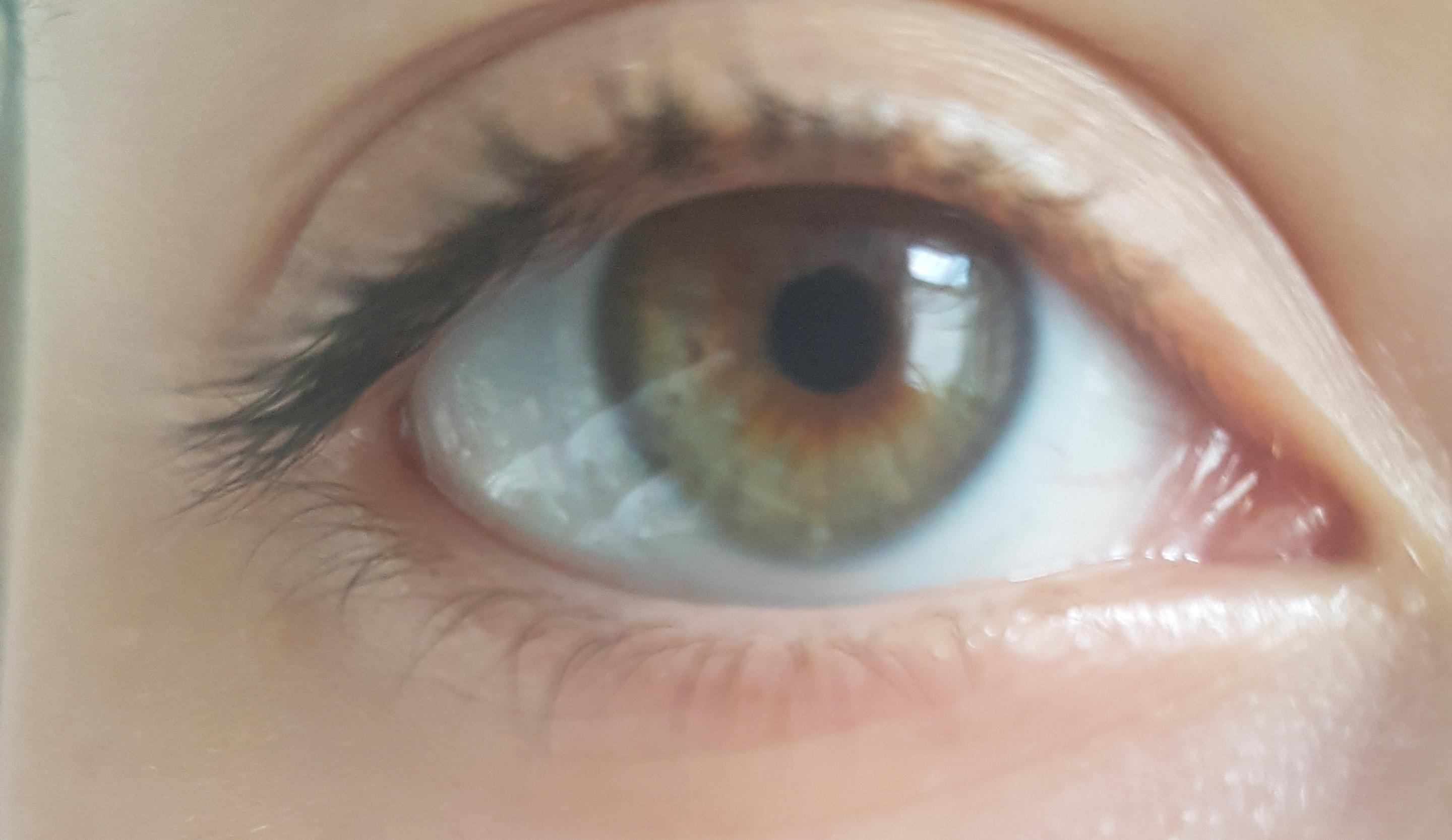 Sind das Hazel Eyes? Und ist das eine Zentrale Heterocromie? Welche