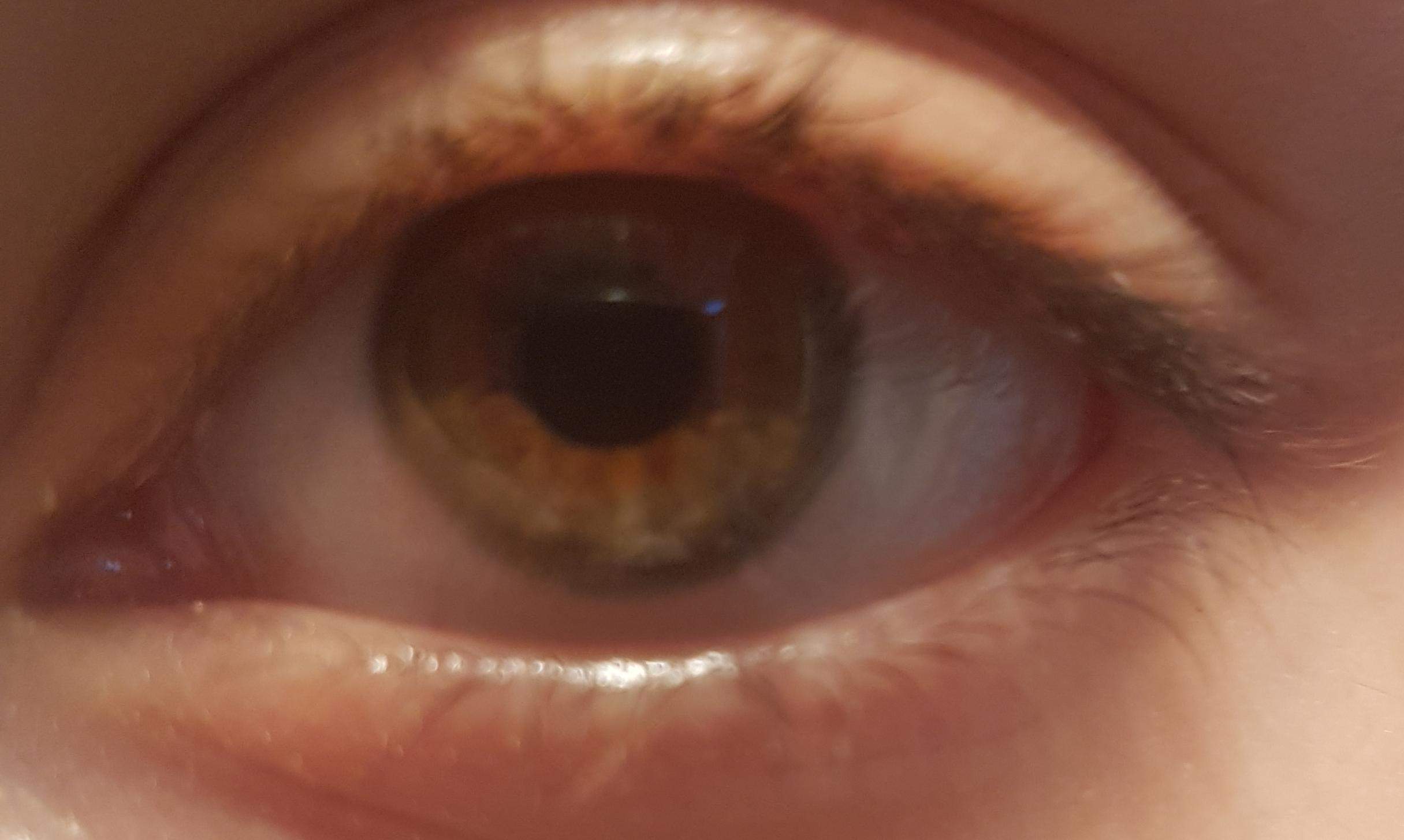 Sind das Hazel Eyes? Und ist das eine Zentrale Heterocromie? Welche Augenfarbe ist das? (Augen