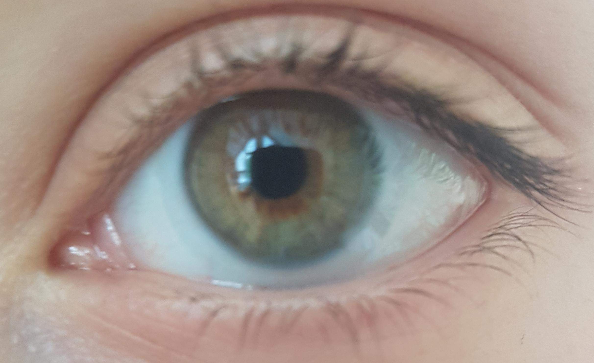 Sind das Hazel Eyes? Und ist das eine Zentrale Heterocromie? Welche Augenfarbe ist das? (Augen