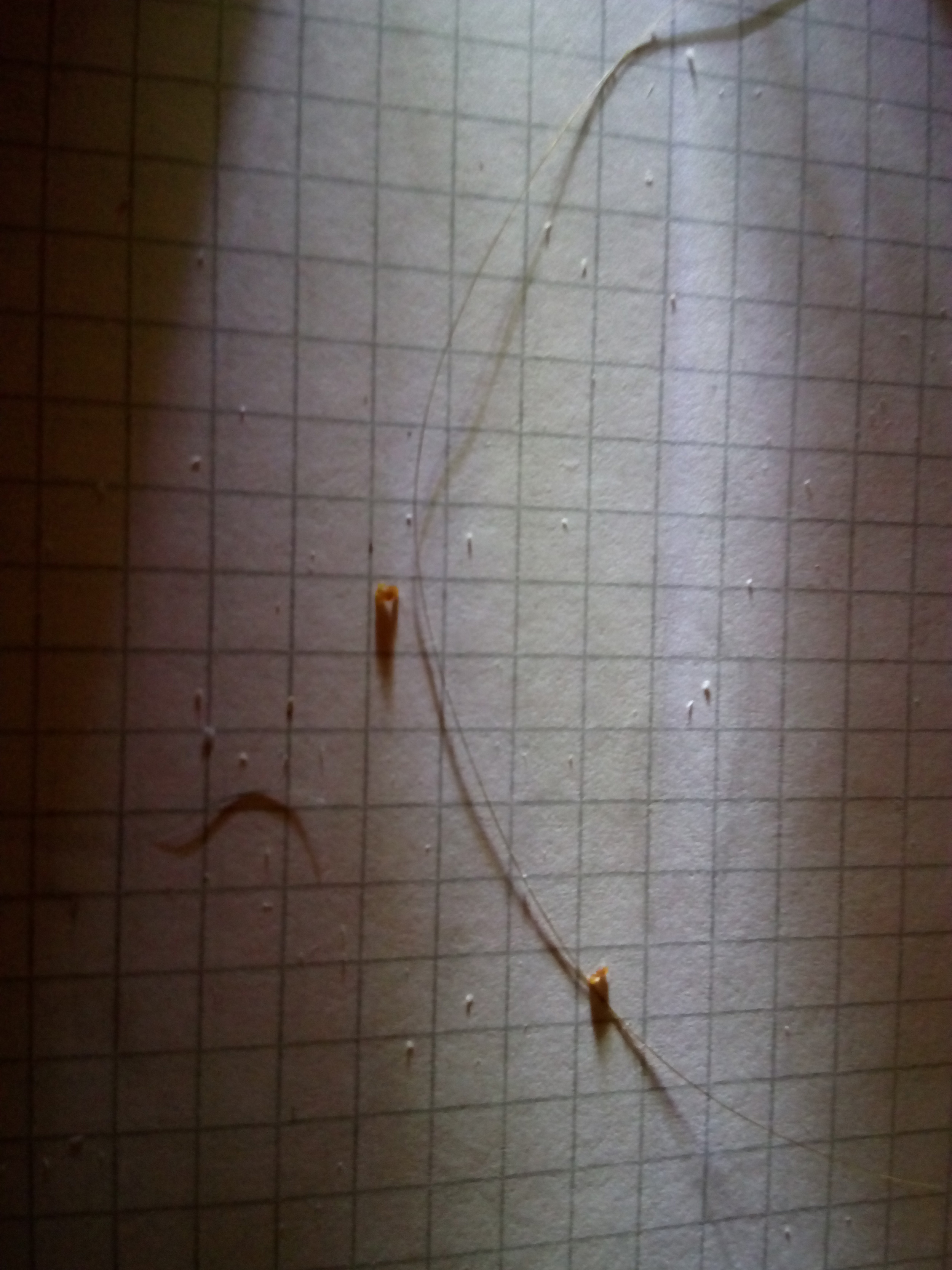 Sind Das Lause Oder Nicht Gesundheit