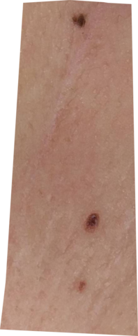 Bild - (Angst, Haut)