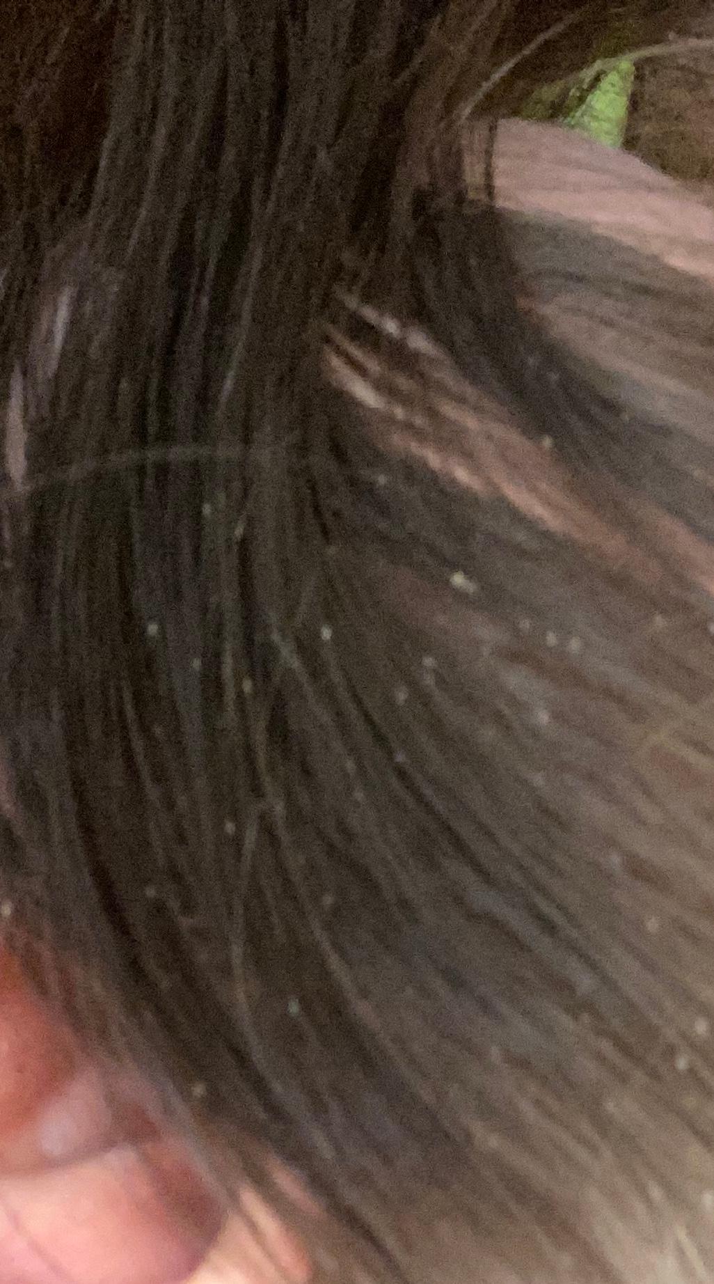 sind das schuppen oder lause bild unten