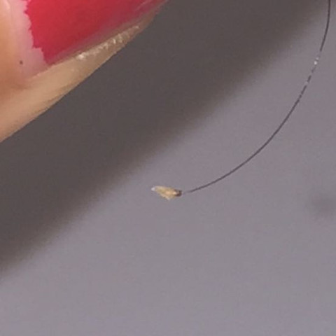 haare jucken kopfhaut