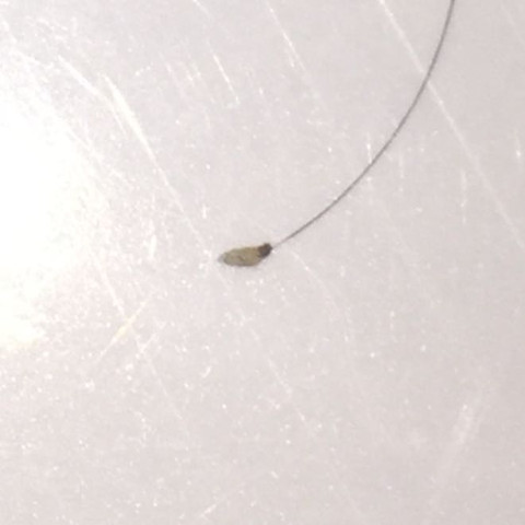 haare jucken kopfhaut