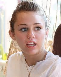 Segelohren Segelohren