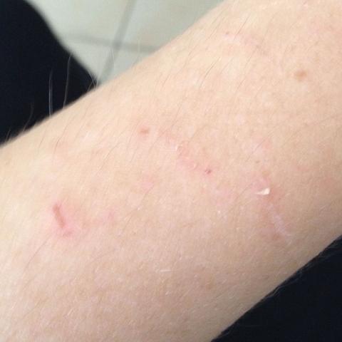 Sind Diese Bisswunden Noch Normal Fur Einen Welpen Oder Ist Das Schon Zu Heftig Tiere Hund Hundeerziehung