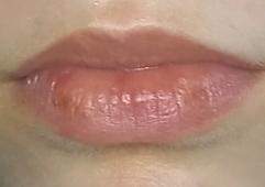 Sind diese Lippen gespritzt oder echt?