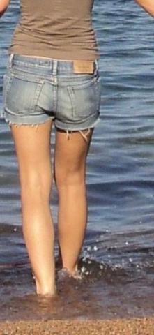 Sind Diese Waden Fett Wer Hat Sich Sich Die Waden Operativ Verkleinern Lassen Beauty Beine Schonheits Op