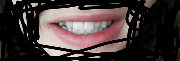 Das sind ihre Zähne  - (Zähne, Schönheit)