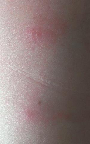 Sind Es Flohbisse Oder Muckenstiche Gesundheit Katze