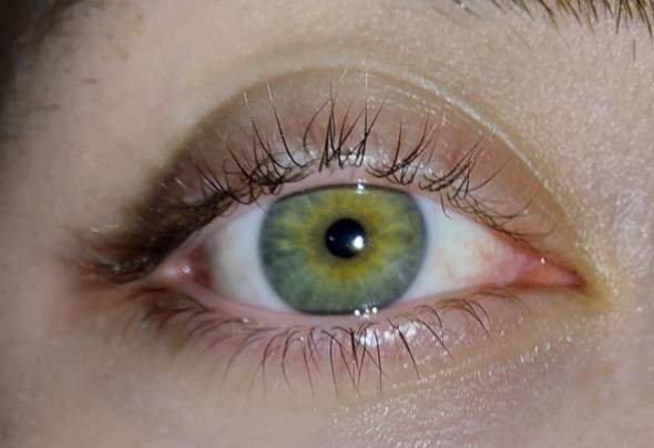 Sind meine Augen besonders oder normal?