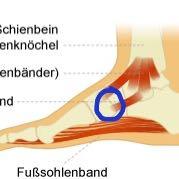 Da ist zwar ein Band aber es tut mehr am Knochen weh.  - (Schmerzen, Füße, Band)