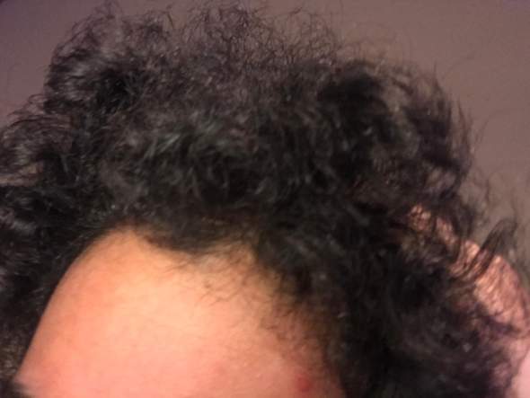 sind meine haare verbrannt gesundheit