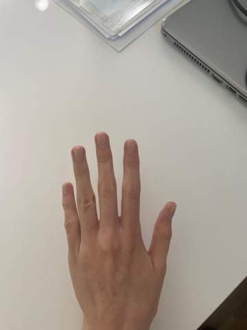 Sind meine Hände hässlich/männlich?