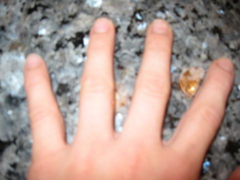 - (Körper, Hand)