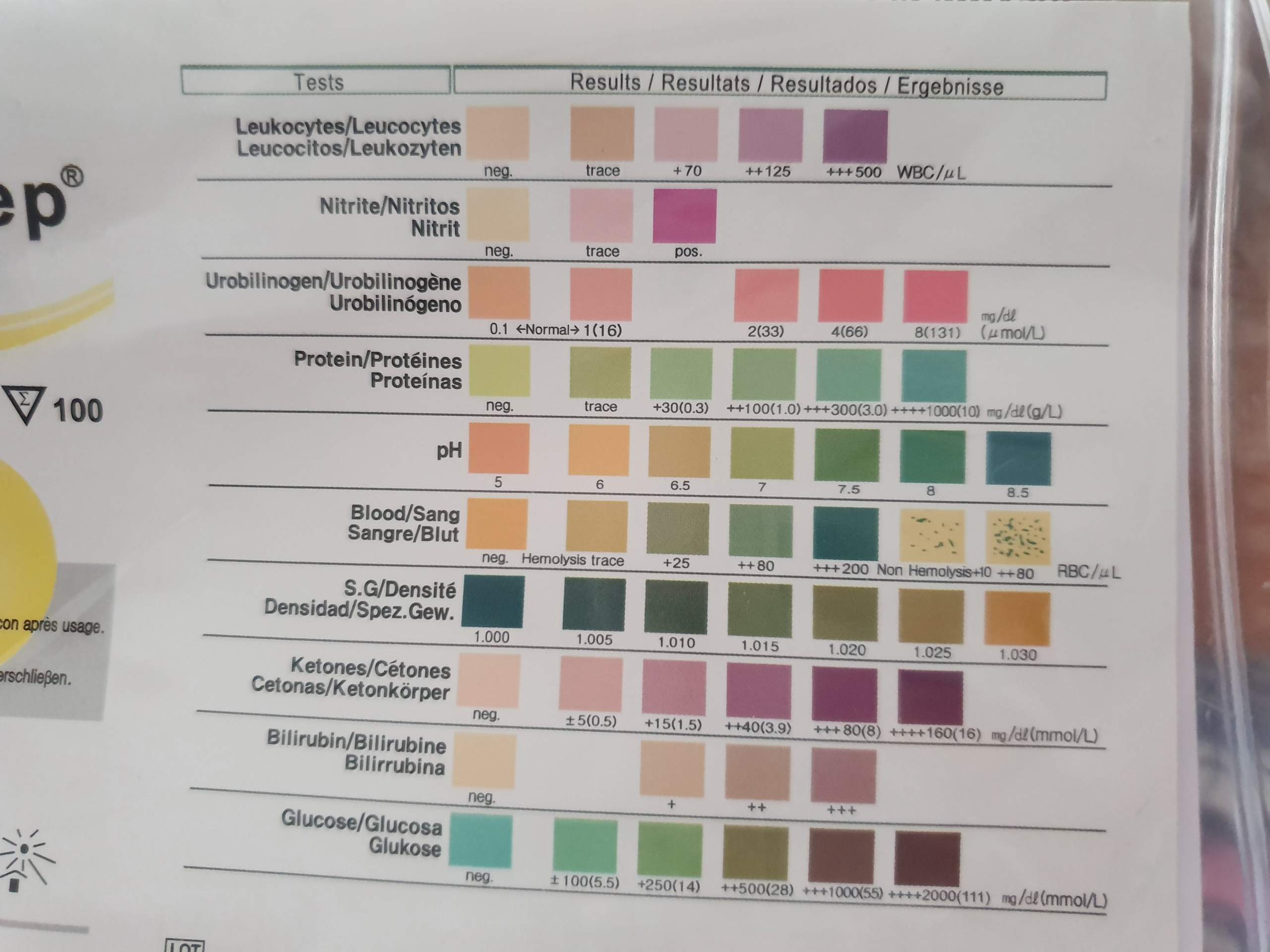 Sind meine Leukozyten im Urin zu viel? (Medizin, Urintest) Sind meine Leukozyten im Urin zu viel? (Medizin, Urintest)