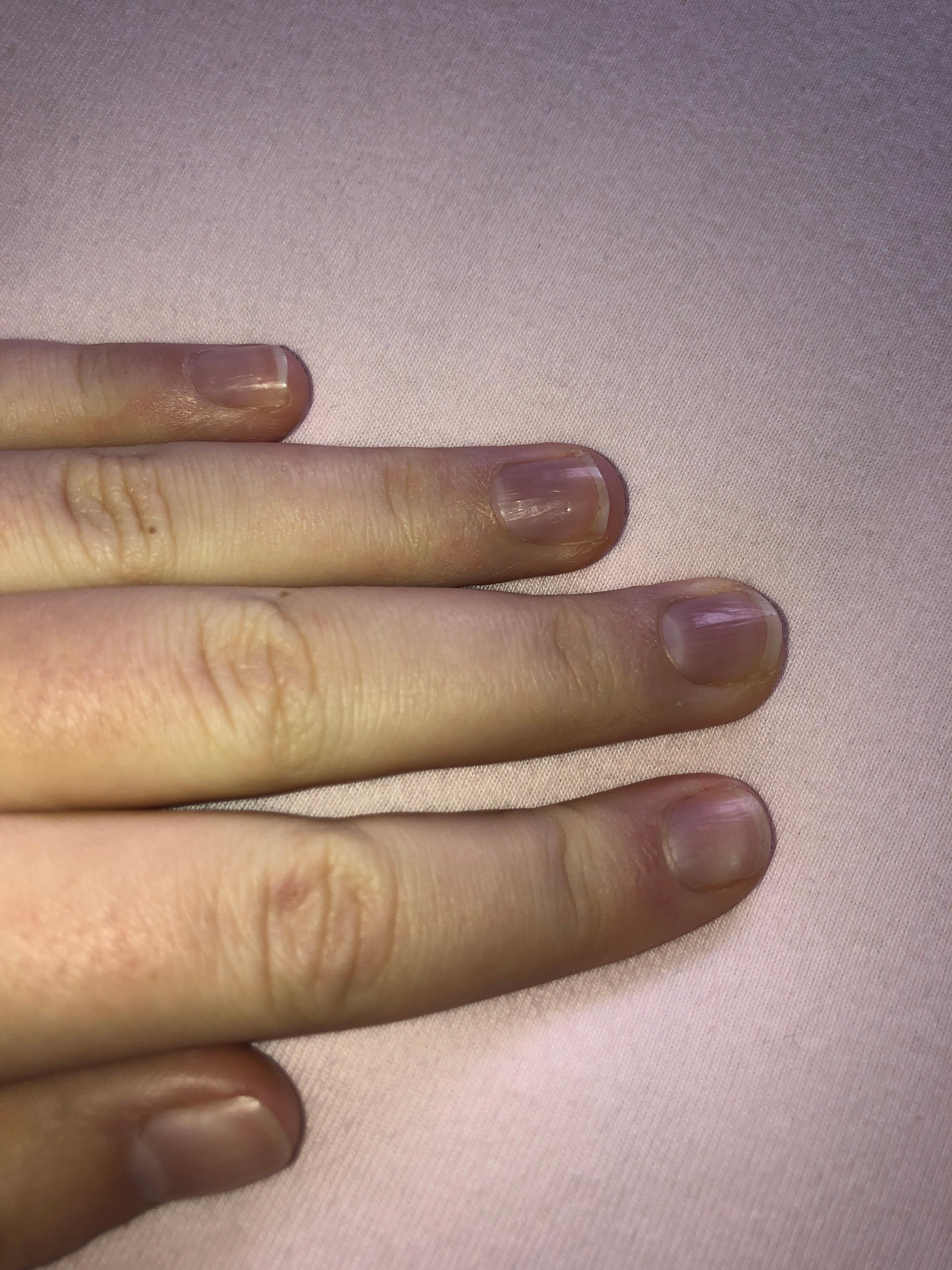 Sind Meine Nagel Lang Genug Fur Gelnagel Fingernagel Nagelstudio